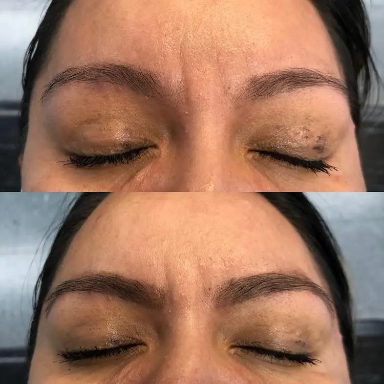 Eyebrow11
